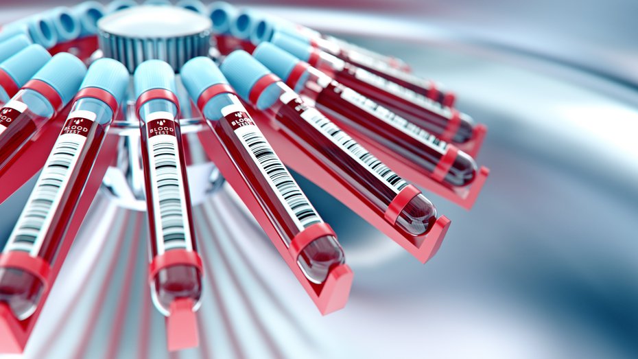 Blutzentrifugierung im Labor Laborgerät, das Blut zentrifugiert