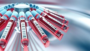 Blutzentrifugierung im Labor Laborgerät, das Blut zentrifugiert