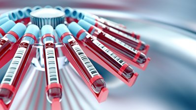 Laborgerät, das Blut zentrifugiert